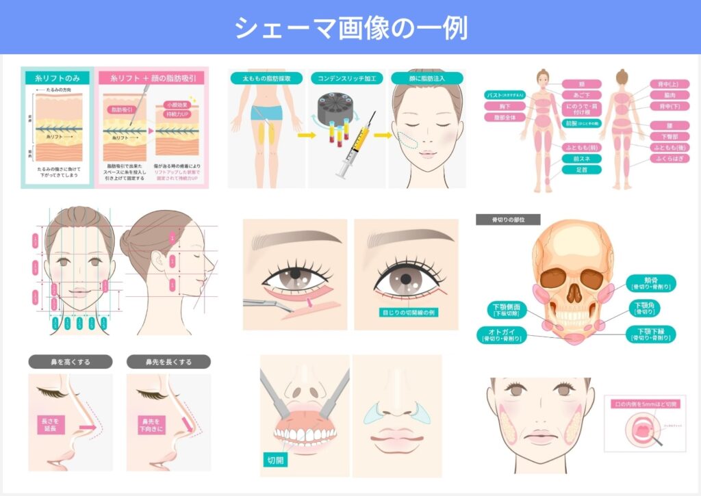 シェーマ画像の一例