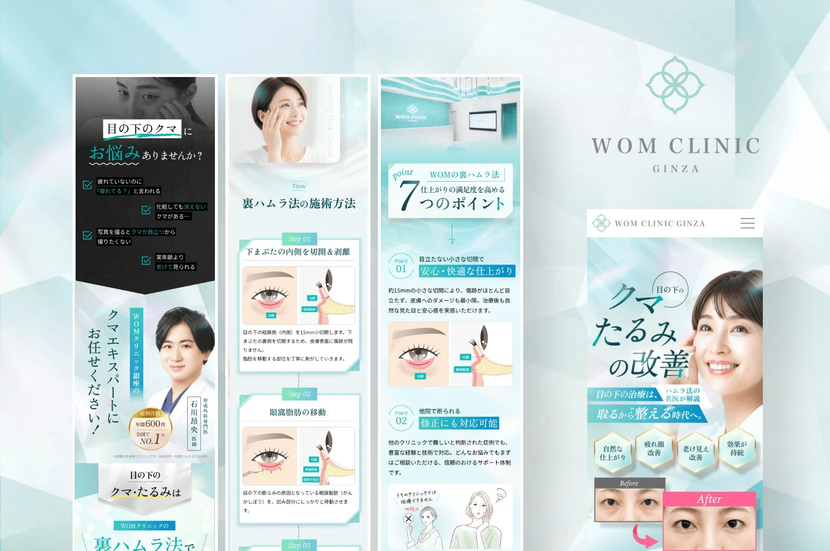 WOM CLINIC GINZA クマ治療LP