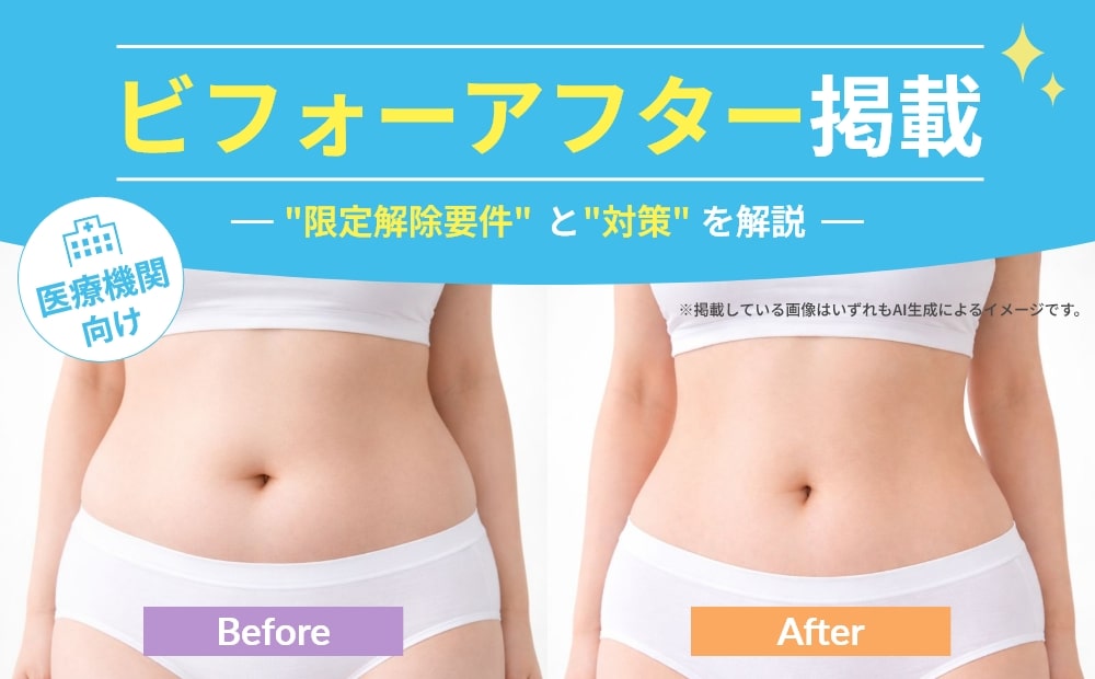 ビフォーアフター掲載