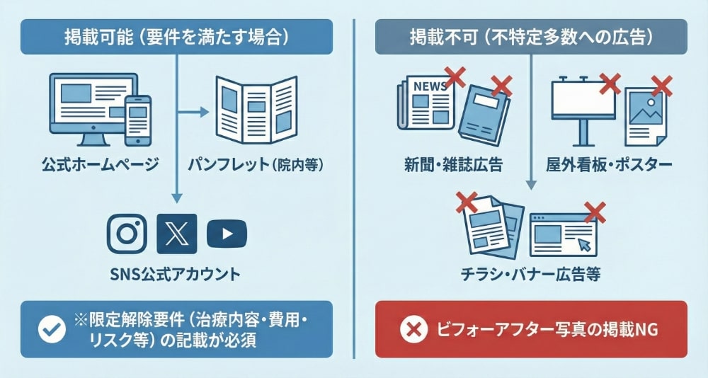 掲載可能な媒体・掲載不可の媒体