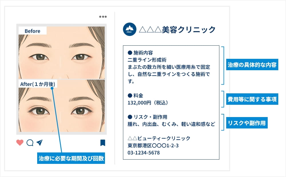 ビフォーアフター