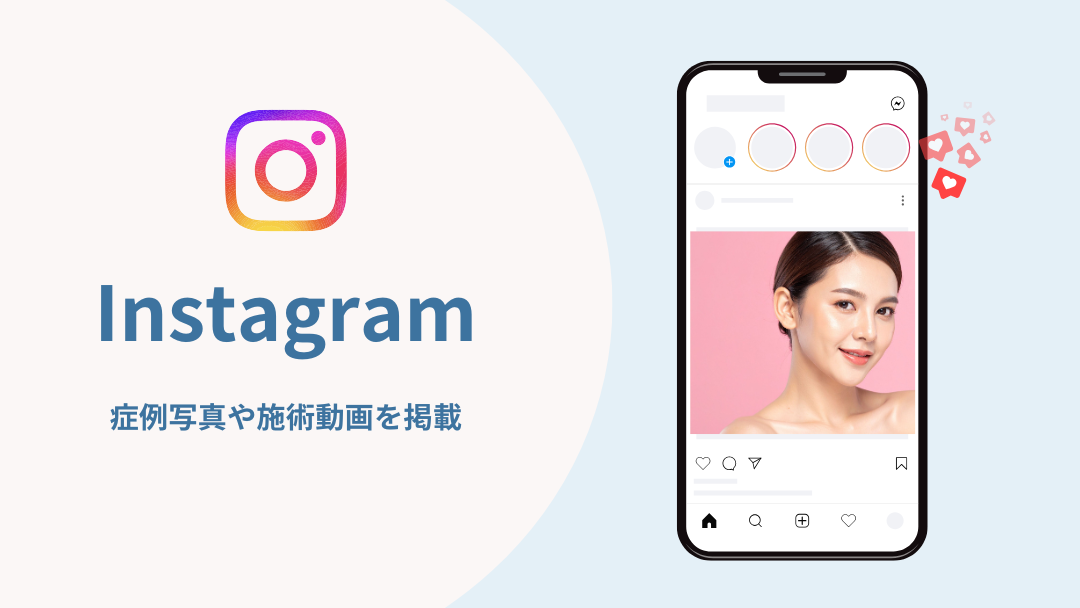 インスタグラム