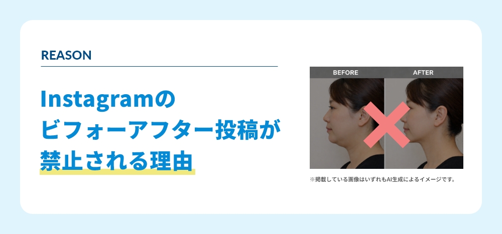 インスタ ビフォーアフターが禁止される理由