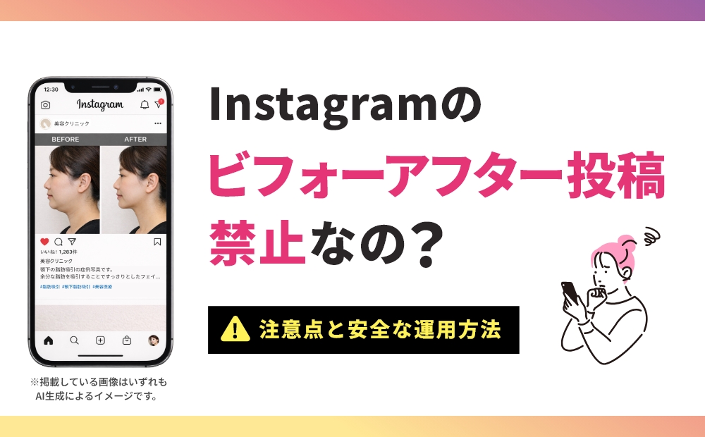 インスタ ビフォーアフター 禁止